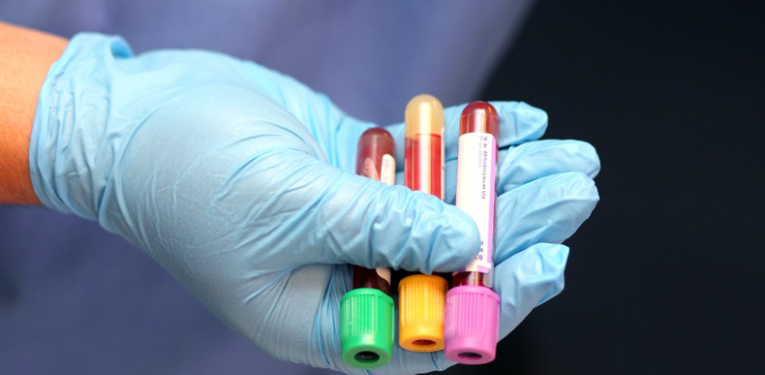 Without Phlebotomy, Advancements in the Medical Area Would Be Difficult